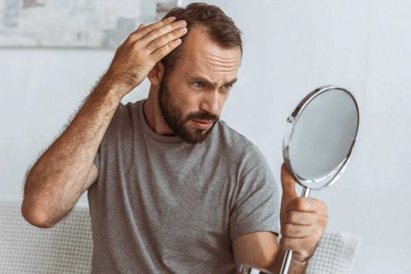 Mann mit Haarverlust schaut sich in den Spiegel