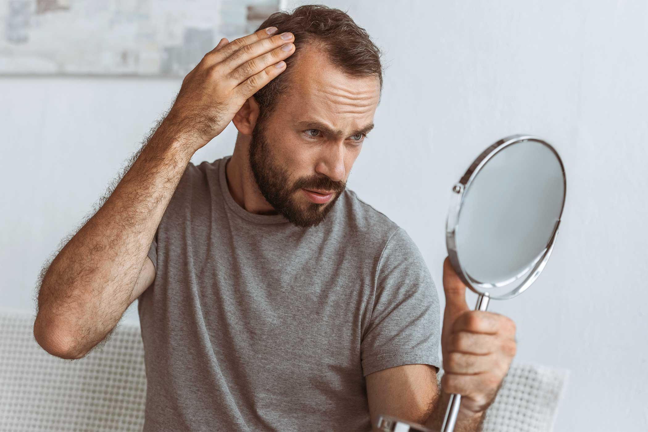 Mann mit Haarausfall